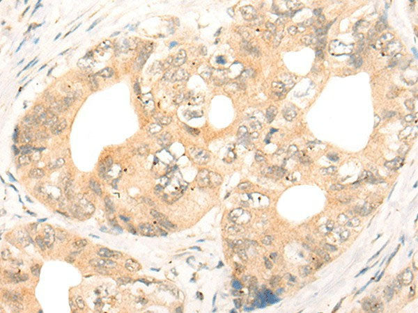CD86 Polyclonal Antibody Reactivity Human