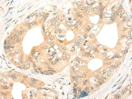 CD86 Polyclonal Antibody Reactivity Human