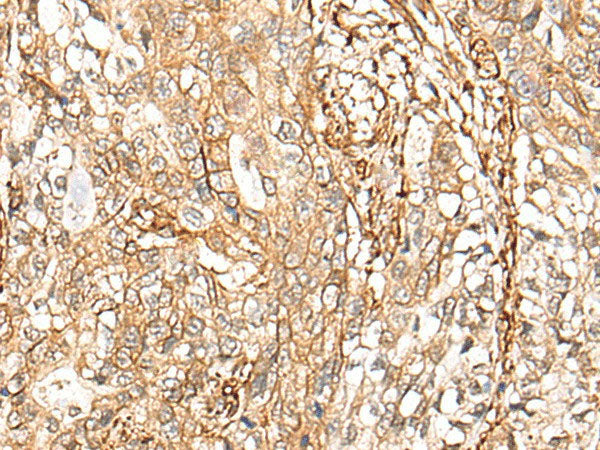 CD99 Polyclonal Antibody Reactivity Human