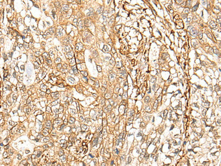 CD99 Polyclonal Antibody Reactivity Human