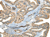 CDADC1 Polyclonal Antibody Reactivity Human