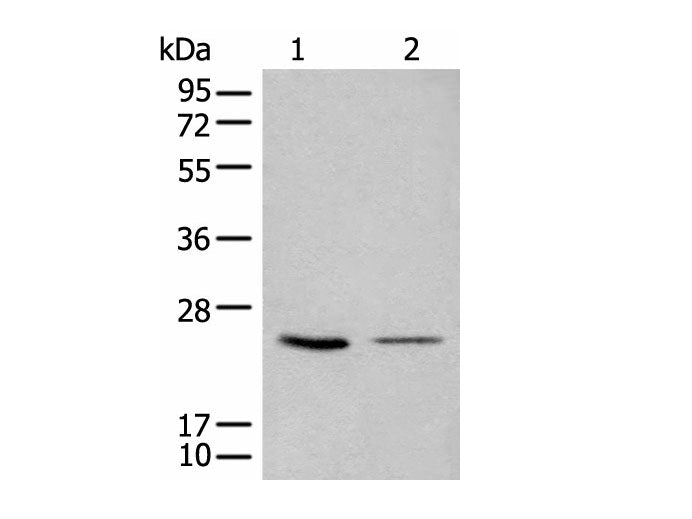 CDCA4 Polyclonal Antibody Reactivity Human