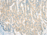 CDKAL1 Polyclonal Antibody Reactivity Human