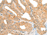 CECR1 Polyclonal Antibody