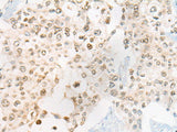CEP72 Polyclonal Antibody