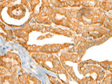CEP72 Polyclonal Antibody