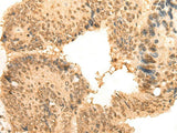 CEP57 Polyclonal Antibody Reactivity Human