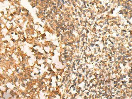 CEP57 Polyclonal Antibody Reactivity Human