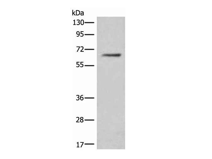 CEP57 Polyclonal Antibody Reactivity Human