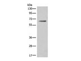 CEP57 Polyclonal Antibody Reactivity Human
