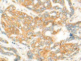CFHR2 Polyclonal Antibody