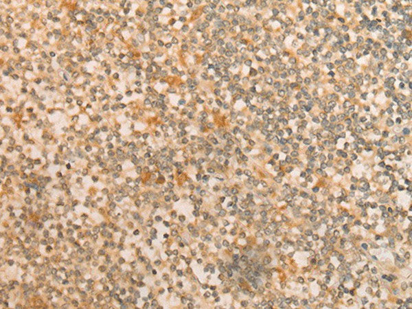 CFHR2 Polyclonal Antibody