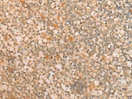 CFHR2 Polyclonal Antibody