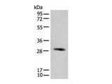 CFHR2 Polyclonal Antibody