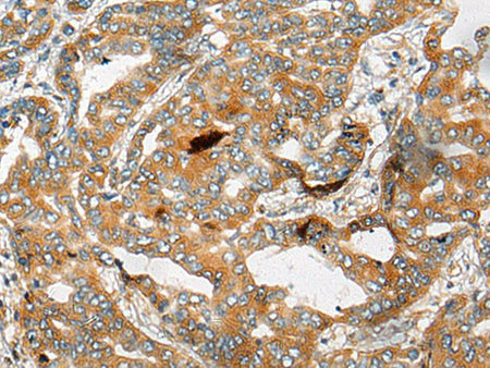 CHCHD3 Polyclonal Antibody Reactivity Human