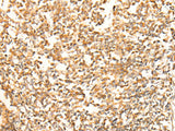 CHCHD3 Polyclonal Antibody Reactivity Human