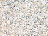 CHMP6 Polyclonal Antibody Reactivity Human