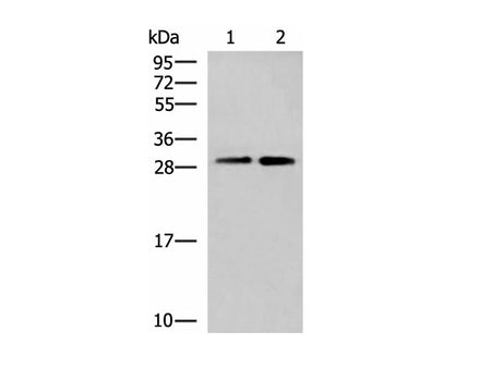 TBCB Polyclonal Antibody Reactivity Human