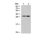 TBCB Polyclonal Antibody Reactivity Human