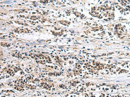 CLCN7 Polyclonal Antibody Reactivity Human