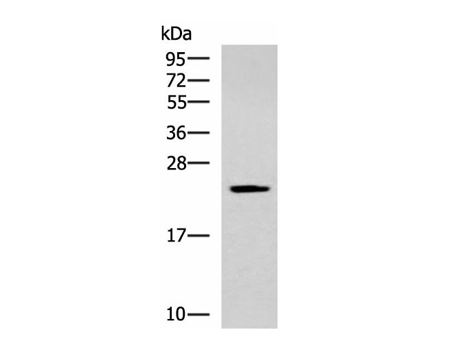 CMPK1 Polyclonal Antibody