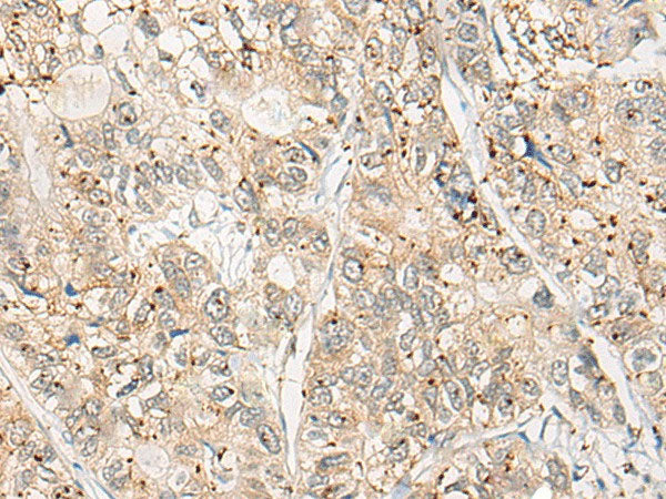 CPNE4 Polyclonal Antibody