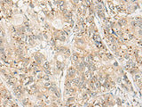 CPNE4 Polyclonal Antibody