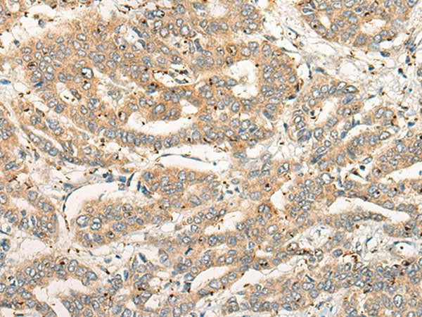CPNE4 Polyclonal Antibody