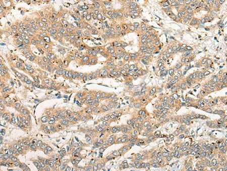 CPNE4 Polyclonal Antibody
