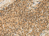 CRCP Polyclonal Antibody Reactivity Human