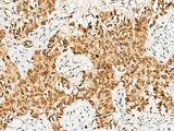 CRCP Polyclonal Antibody Reactivity Human