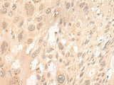 CUTA Polyclonal Antibody Reactivity Human