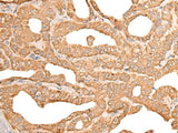 CUTA Polyclonal Antibody Reactivity Human