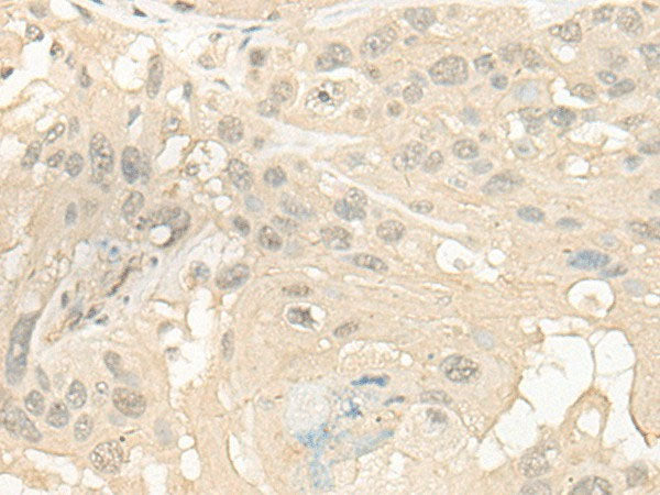CYP4X1 Polyclonal Antibody Reactivity Human