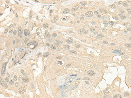CYP4X1 Polyclonal Antibody Reactivity Human