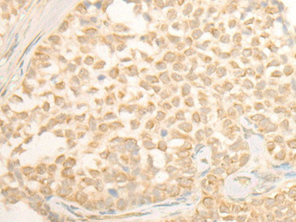 CYP4X1 Polyclonal Antibody Reactivity Human