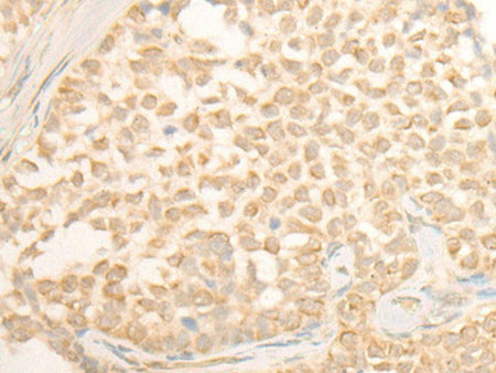 CYP4X1 Polyclonal Antibody Reactivity Human