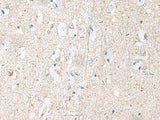 DACT3 Polyclonal Antibody