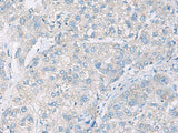 DACT3 Polyclonal Antibody