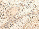 DAZ1 Polyclonal Antibody