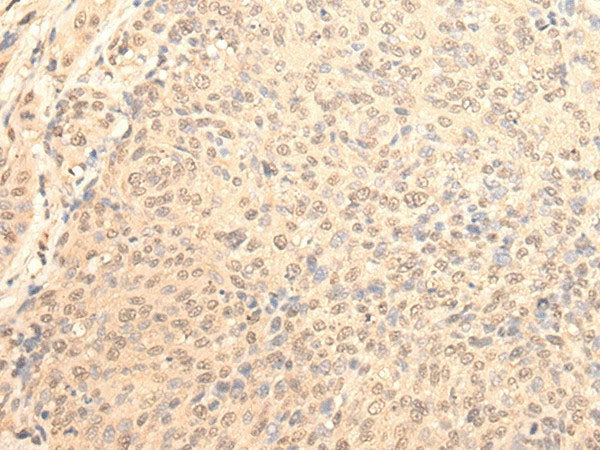 DAZ1 Polyclonal Antibody