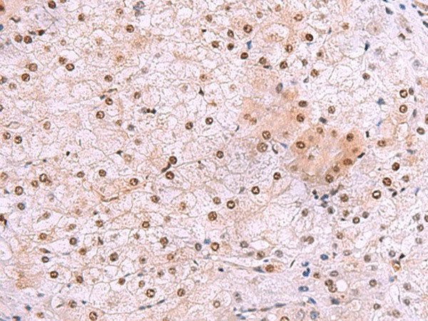 DDI2 Polyclonal Antibody