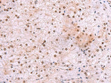 DDI2 Polyclonal Antibody