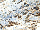 DDX39A Polyclonal Antibody