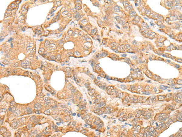 DEF8 Polyclonal Antibody