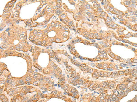 DEF8 Polyclonal Antibody