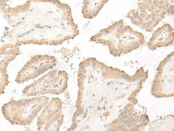 DCD Polyclonal Antibody