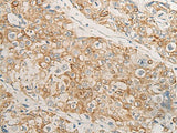 HLA-DMB Polyclonal Antibody Reactivity Human