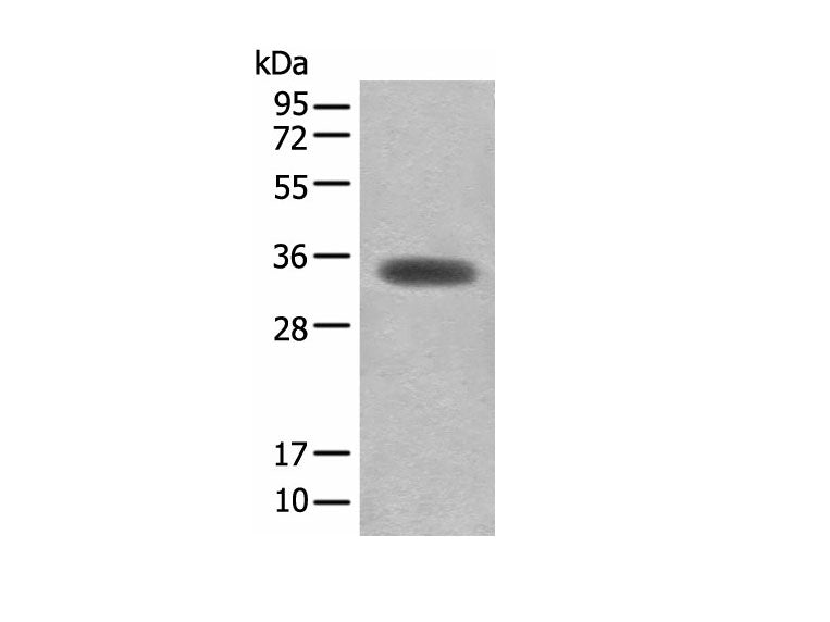 MYOZ2 Polyclonal Antibody Reactivity Human
