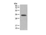 MYOZ2 Polyclonal Antibody Reactivity Human
